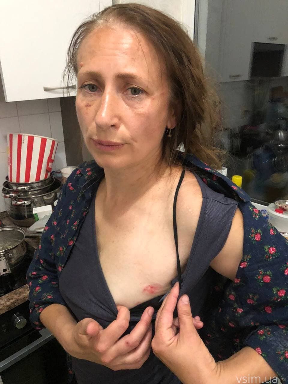 Новини Хмельницького - фото з Жінки на Інститутській побилися за собак. Дві сторони конфлікту