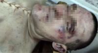 Новини Житомира - фото з Чи буде покарання? У житомирській колонії до смерті закатували ув’язненого та сфабрикували діагноз