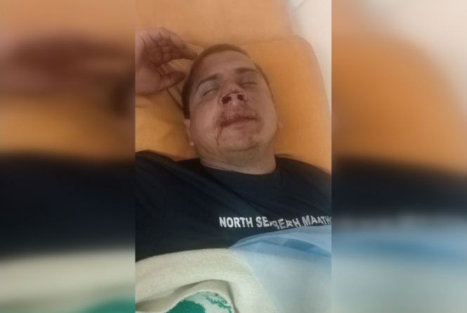 Новини Вінниці - фото з Справа валютчиків, побитий айдарівець та інше важливе за 10 серпня на 20minut.ua На Вінниччині побили «айдарівця», який захищав нашу країну на Сході