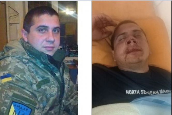 Новини Вінниці - фото з Важливе за тиждень. ТОП новин на 20minut.ua від 15 до 23 серпня, які ви могли пропустити Перекваліфікували провадження, але підозрюваних немає. Нові подробиці справи айдарівця «Фокса»