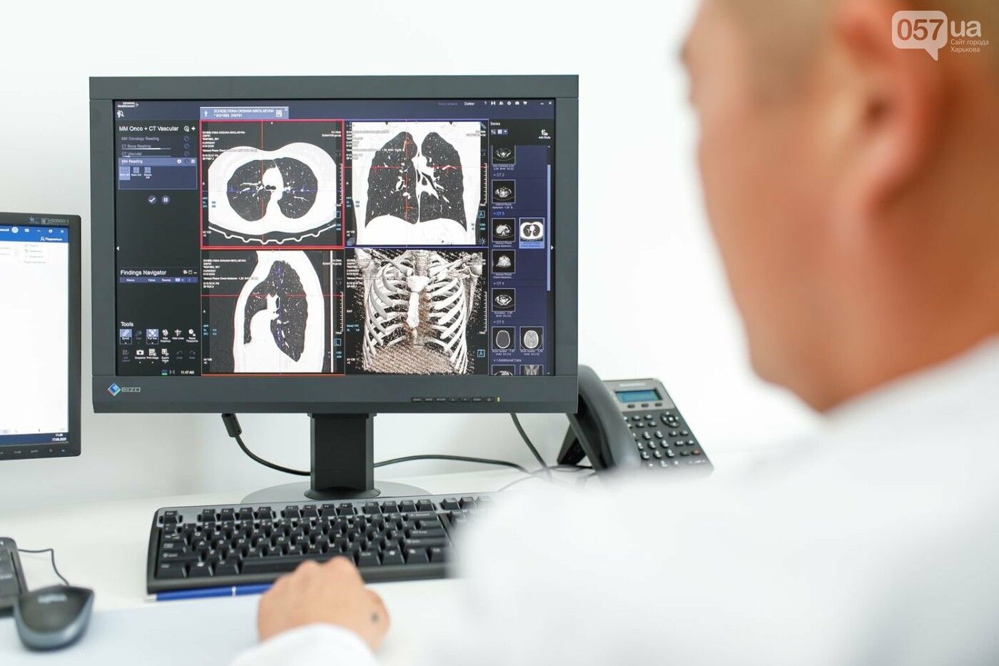 Новини Тернополя - фото з Комп’ютерна томографія при COVID-19. «Оксфорд Медікал» допоможе швидко та якісно провести діагностику (новини компаній)