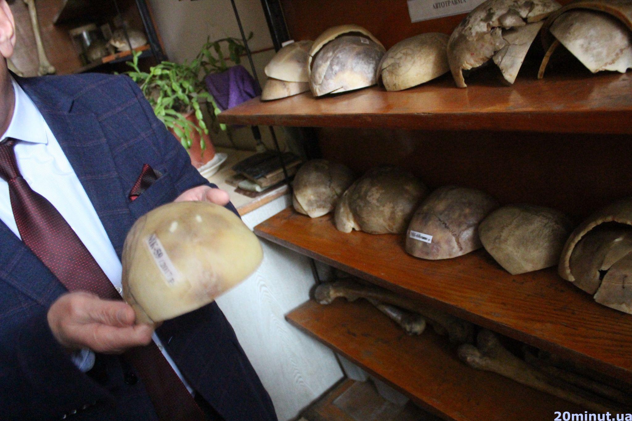 Новини Тернополя - фото з Досліджують частинки трупів і знаряддя вбивств: таємниці роботи судмедекспертів. РЕПОРТАЖ (18+)