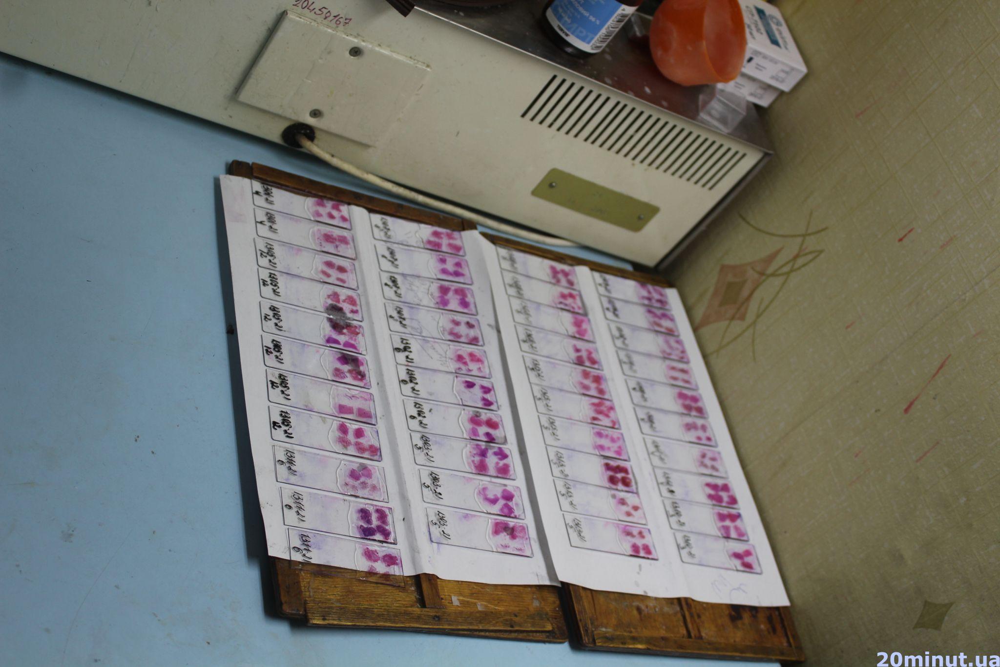 Новини Тернополя - фото з Досліджують частинки трупів і знаряддя вбивств: таємниці роботи судмедекспертів. РЕПОРТАЖ (18+)