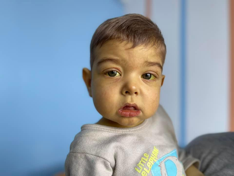 Новини Вінниці - фото з Коли одна смерть рятує інших. Печінку вінницького донора пересадили Артемчику