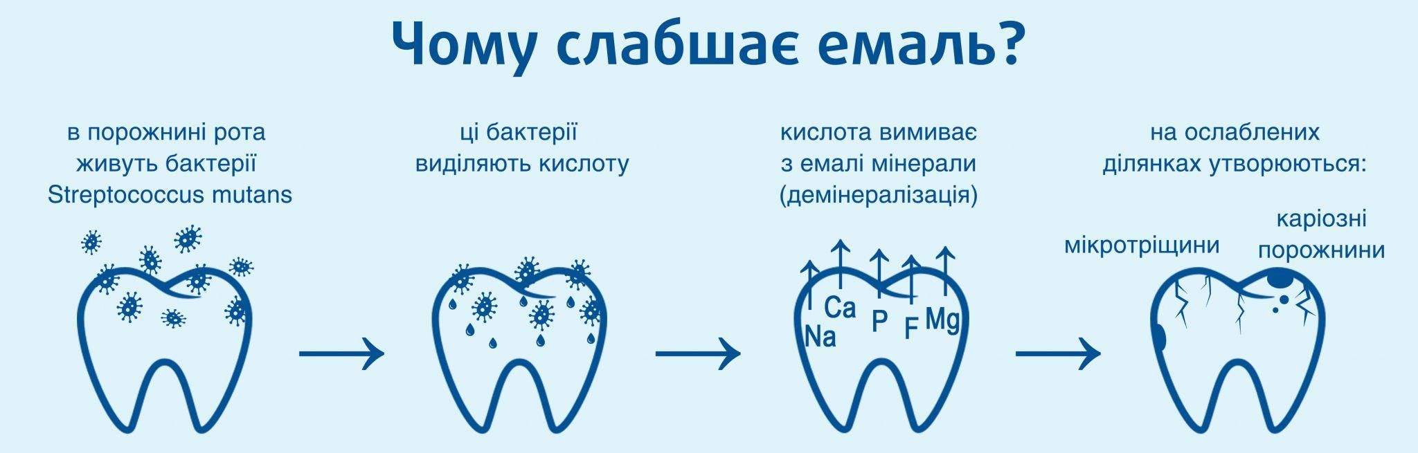 Новини Вінниці - фото з Чому потрібно лікувати молочні зуби дітям? (Новини компаній)