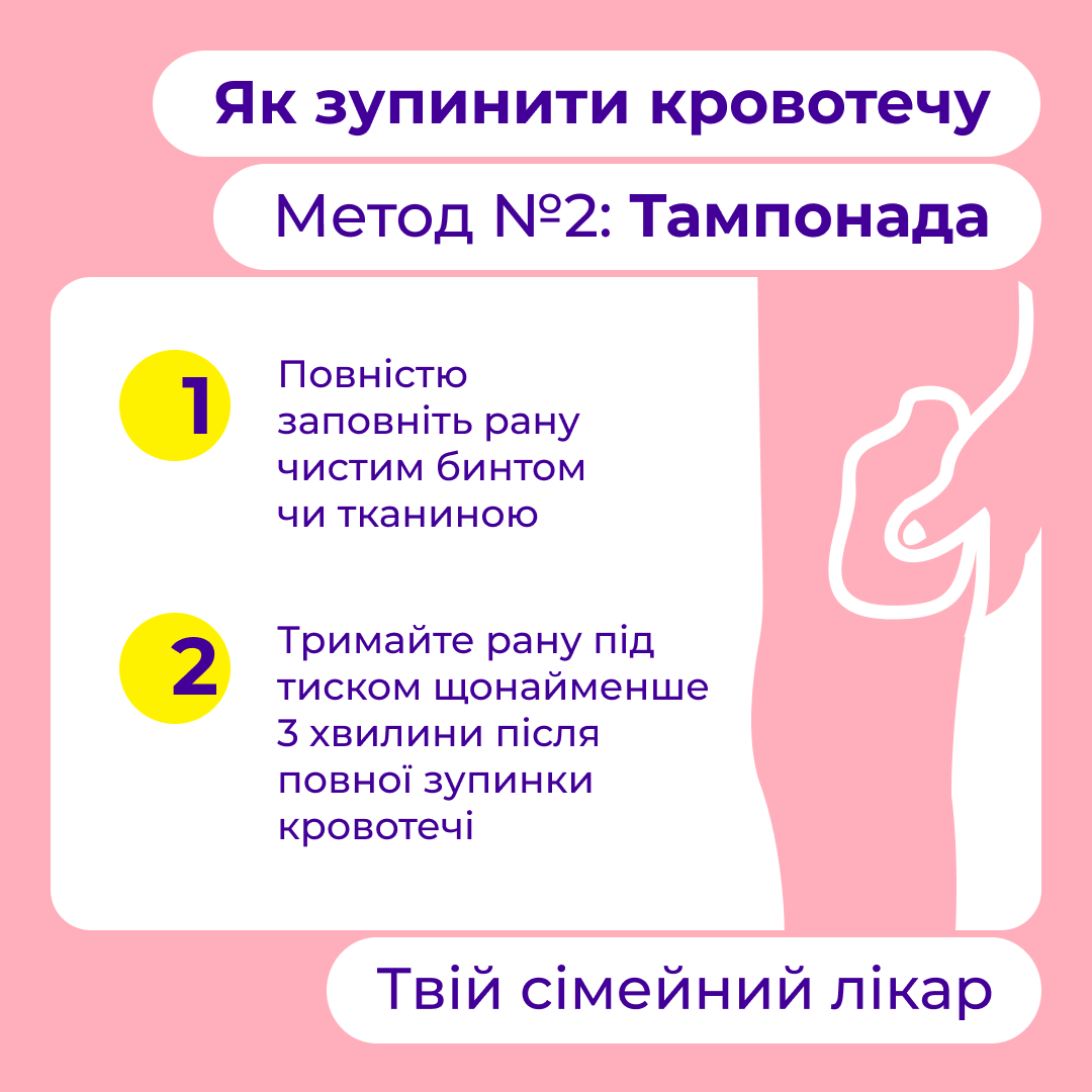 Новини Тернополя - фото з Критична й некритича кровотеча: як розрізнити та що робити до приїзду медиків