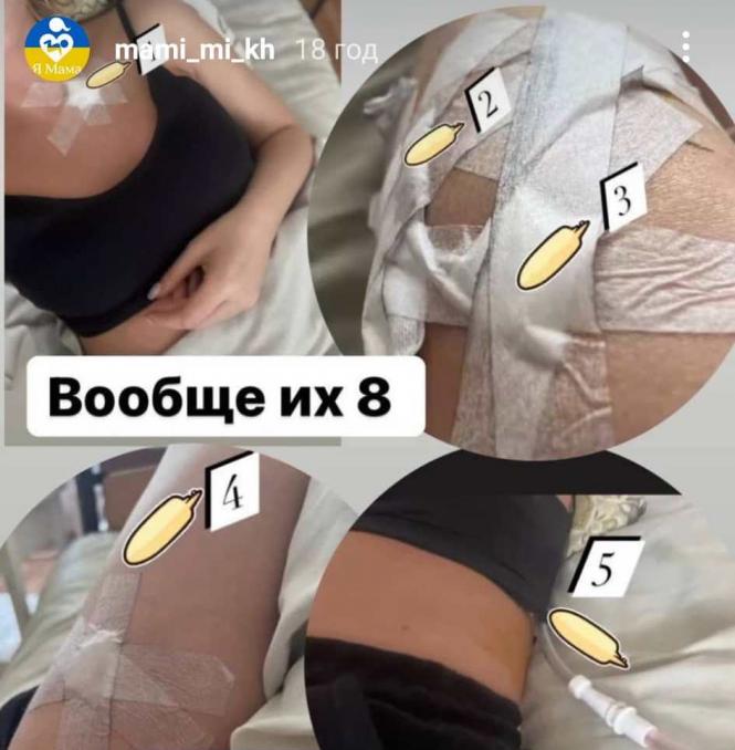 Новини Хмельницького - фото з Чоловік відкрив стрілянину в центрі Хмельницького: що відомо