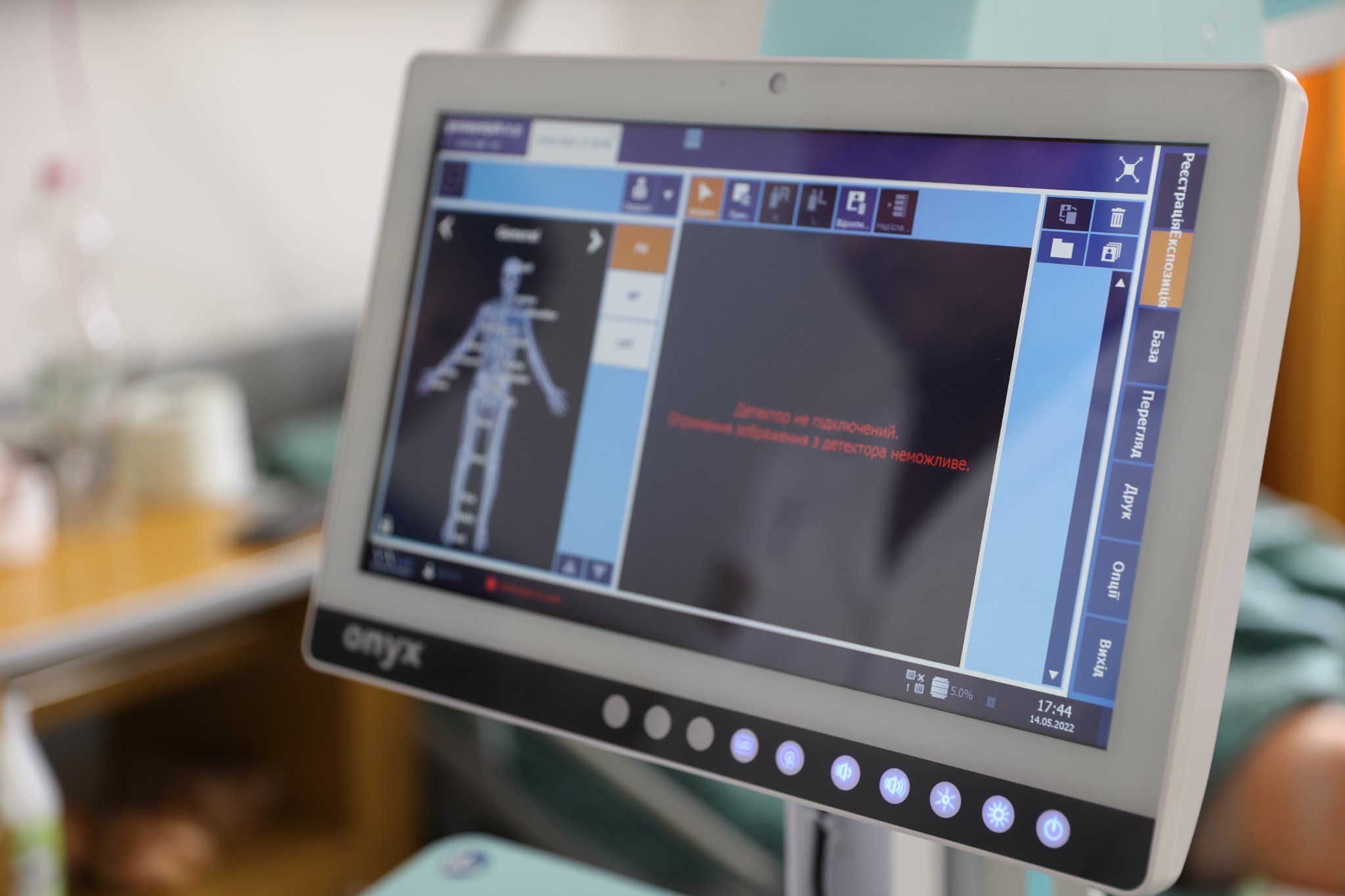 Новини Тернополя - фото з Тернопільська обласна клінічна лікарня отримала нове обладнання