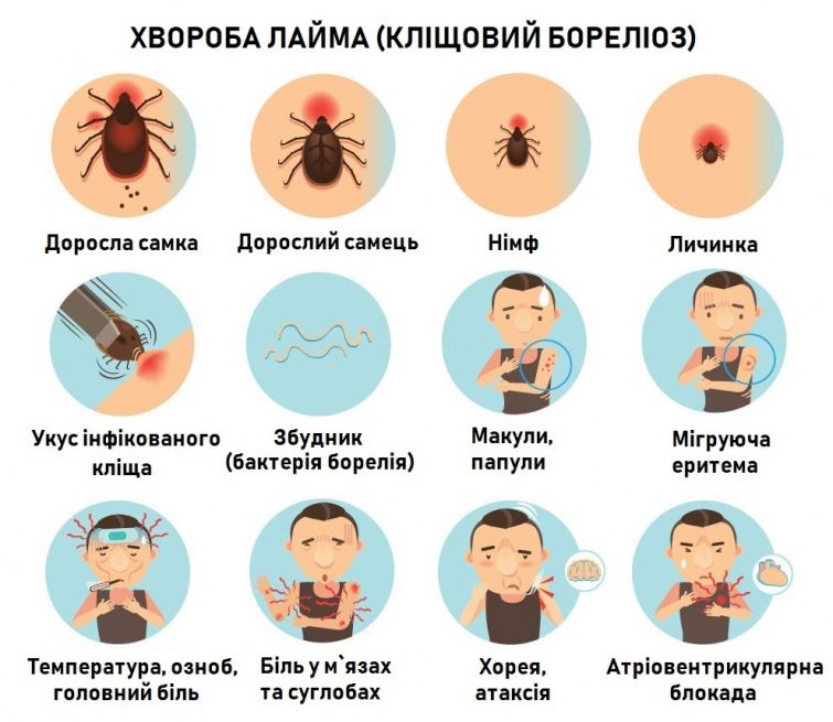 Новини Хмельницького - фото з На Хмельниччині зафіксували 95 випадків бореліозу: як вберегтися
