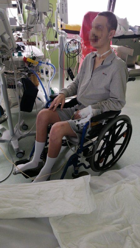 Новини Житомира - фото з 18-річному воїну з передової прогнозували не жити, але він вижив