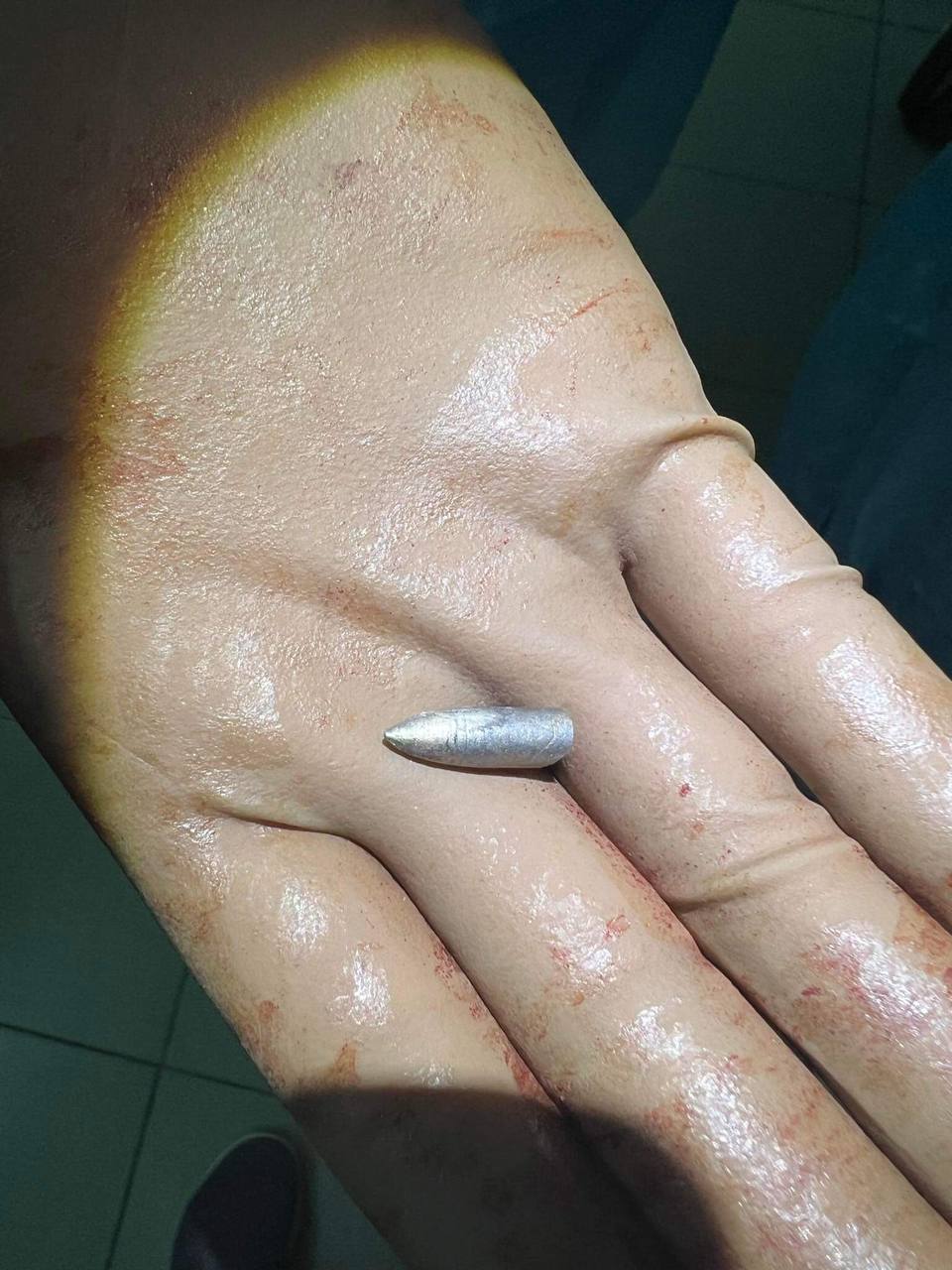 Новини Тернополя - фото з Рятував захисників та поранених цивільних: історія херсонського нейрохірурга, який переїхав до Тернополя