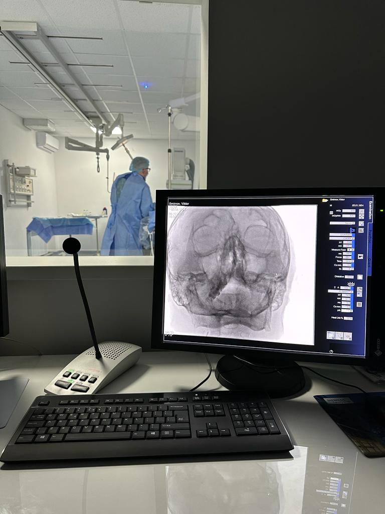 Новини Тернополя - фото з Медики Тернополя провели перші операції у Центрі ендоваскулярної нейрорентгенохірургії