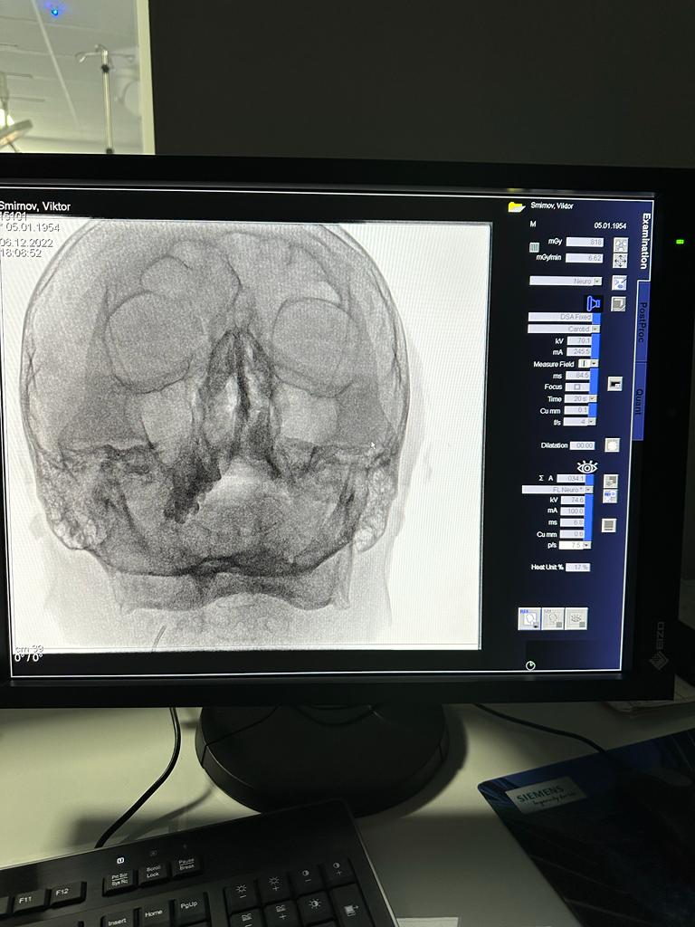 Новини Тернополя - фото з Медики Тернополя провели перші операції у Центрі ендоваскулярної нейрорентгенохірургії