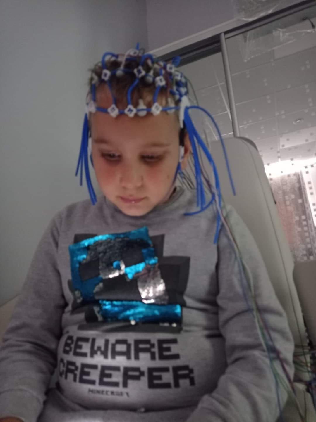 Новини Тернополя - фото з Клітини головного мозку відмирають, але шанс вижити є: допоможіть врятувати малого Давида