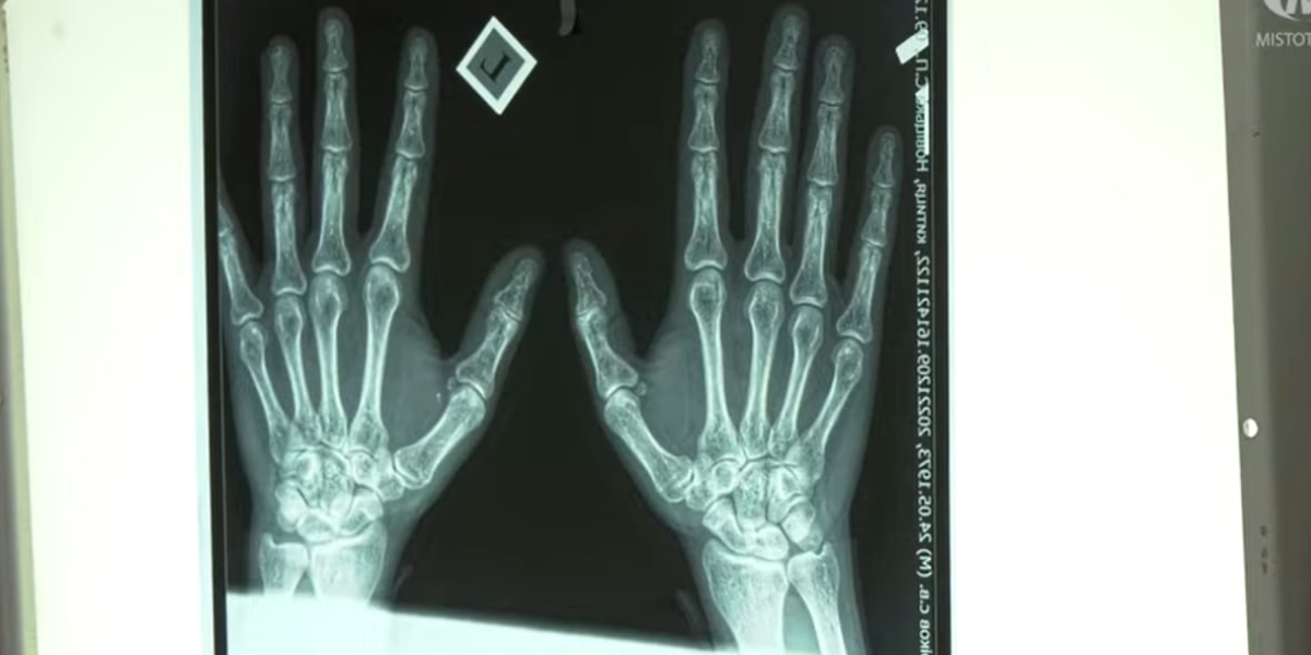 Новини Хмельницького - фото з У хмельницьких поліклініках осучаснили рентген-апарати за 4,4 мільйони