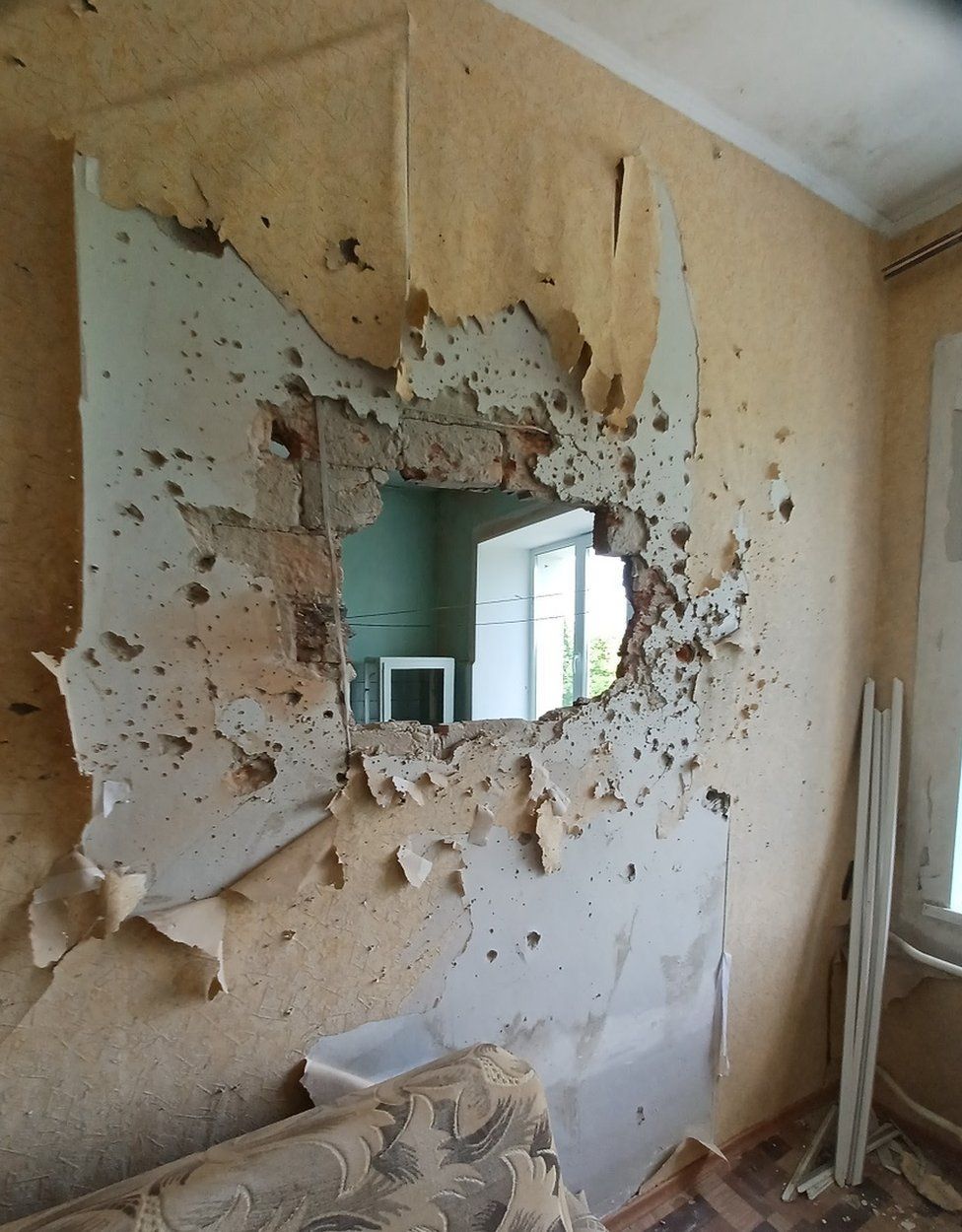 Новини Тернополя - фото з ВВС: Хірург із Хайленду, який працював у Дніпрі, розповів про травми в Україні, як за часів Першої світової