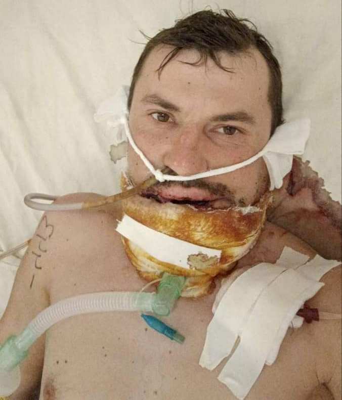 Новини Вінниці - фото з «Він буде жити!». Для пораненого десантника шукають пластичного хірурга