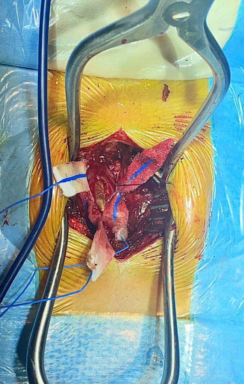 Новини Хмельницького - фото з Куля застрягла у попереку: в Хмельницькому військовому провели унікальну операцію