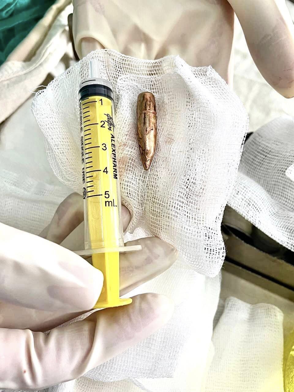 Новини Хмельницького - фото з Куля застрягла у попереку: в Хмельницькому військовому провели унікальну операцію