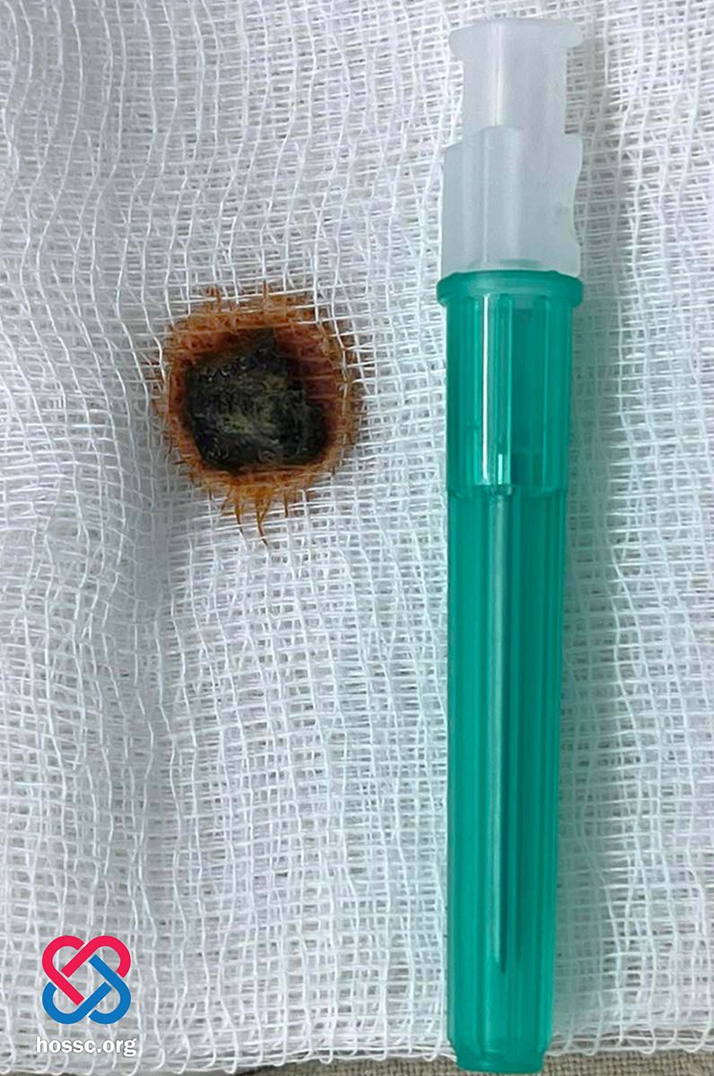 Новини Тернополя - фото з Пробите міною серце захисника з Тернополя продовжувало битись. Як рятували воїна