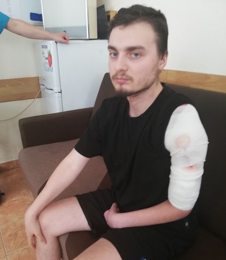 Новини Вінниці - фото з «Були всі підстави для ампутації…» У лікарні №2 Вінниці врятували руку 25-річному командиру роти