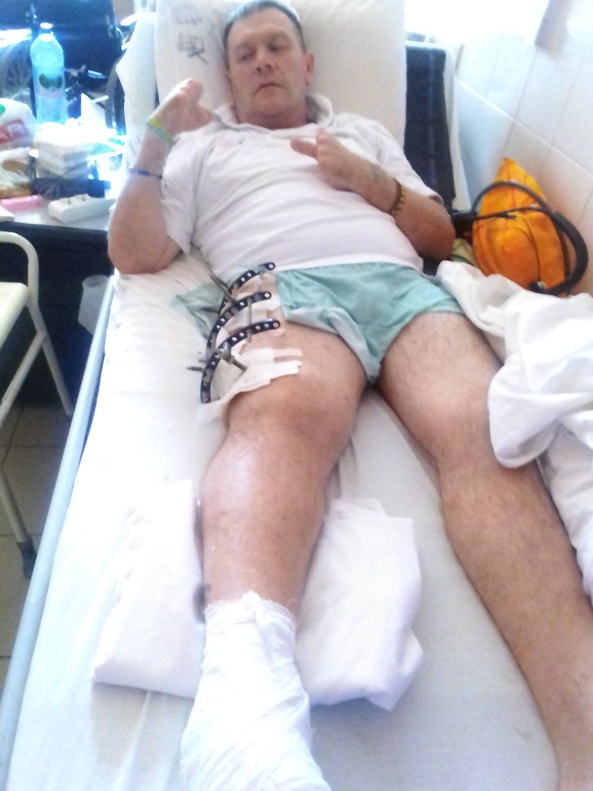 Новини Вінниці - фото з «Відрубали палець кухонним ножем». Звільнений з полону про допит вагнерівців і… довідку для комісії