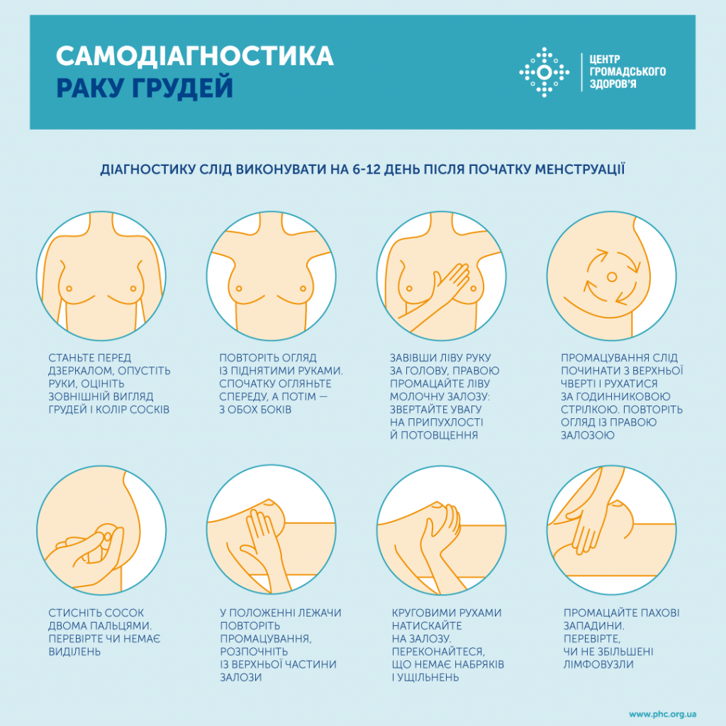 Новини Козятина - фото з Безкоштовна мамографія: як пройти козятинчанкам