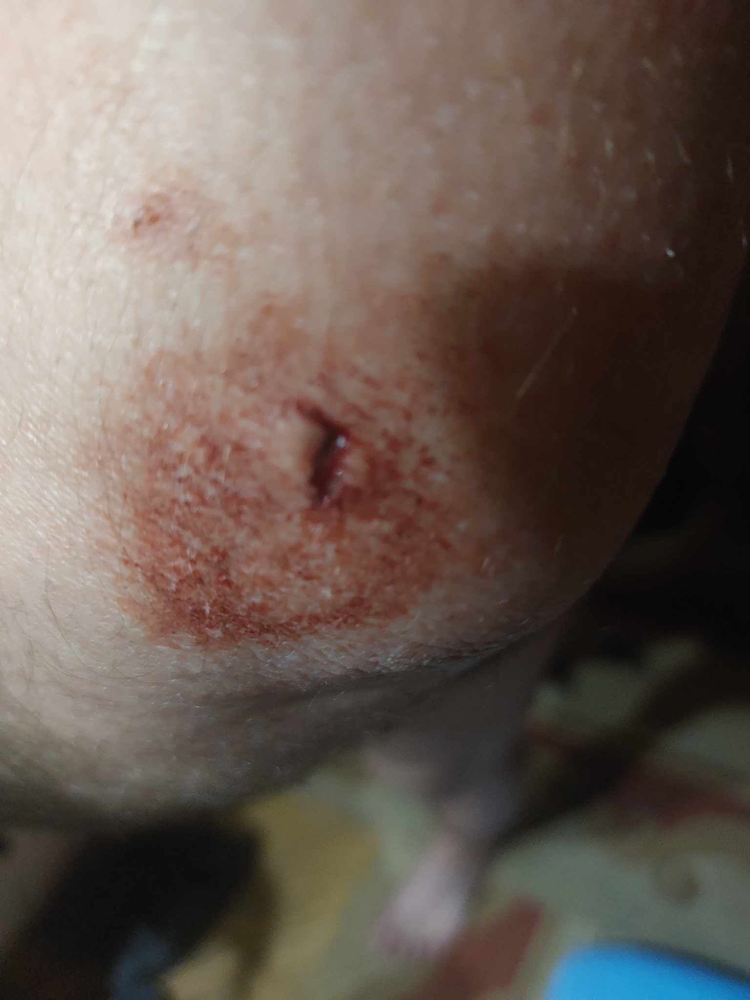 Новини Тернополя - фото з Врятувалися, бо впали на землю, але тіло у порізах від скла.  Як тернополяни пережили ракетний удар