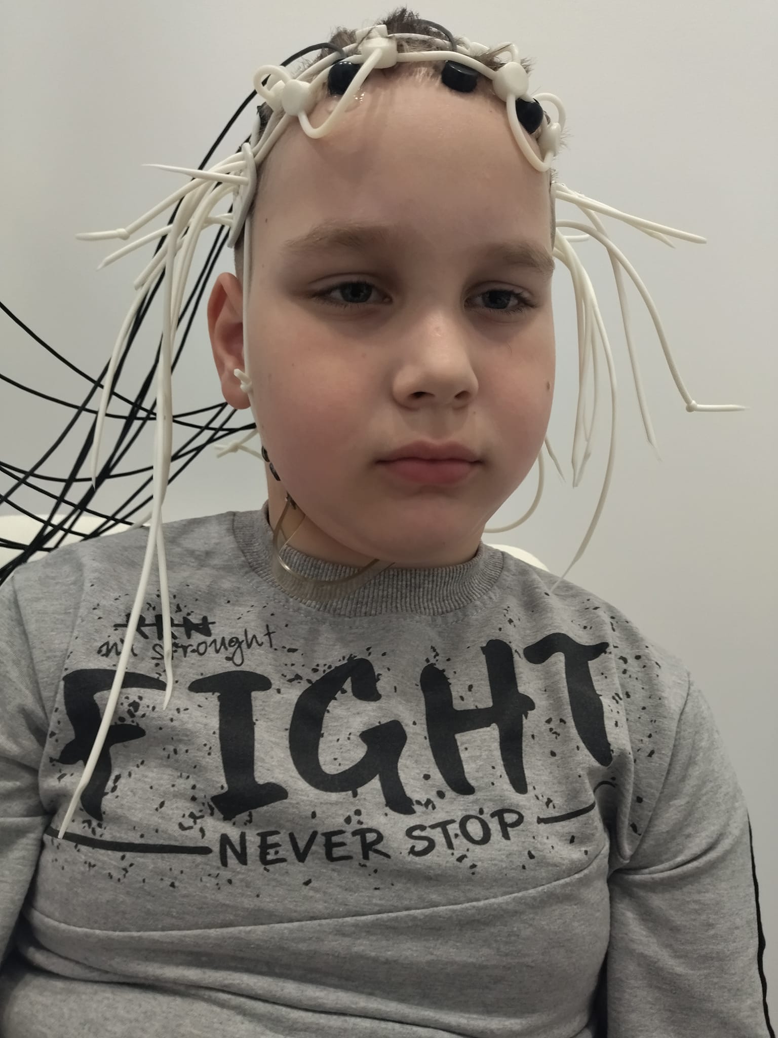 Новини Тернополя - фото з Залишилось зібрати 100 тис. на лікування Давида Ревнюка: батьки просять небайдужих про допомогу На зображенні може бути: 1 особа та коси