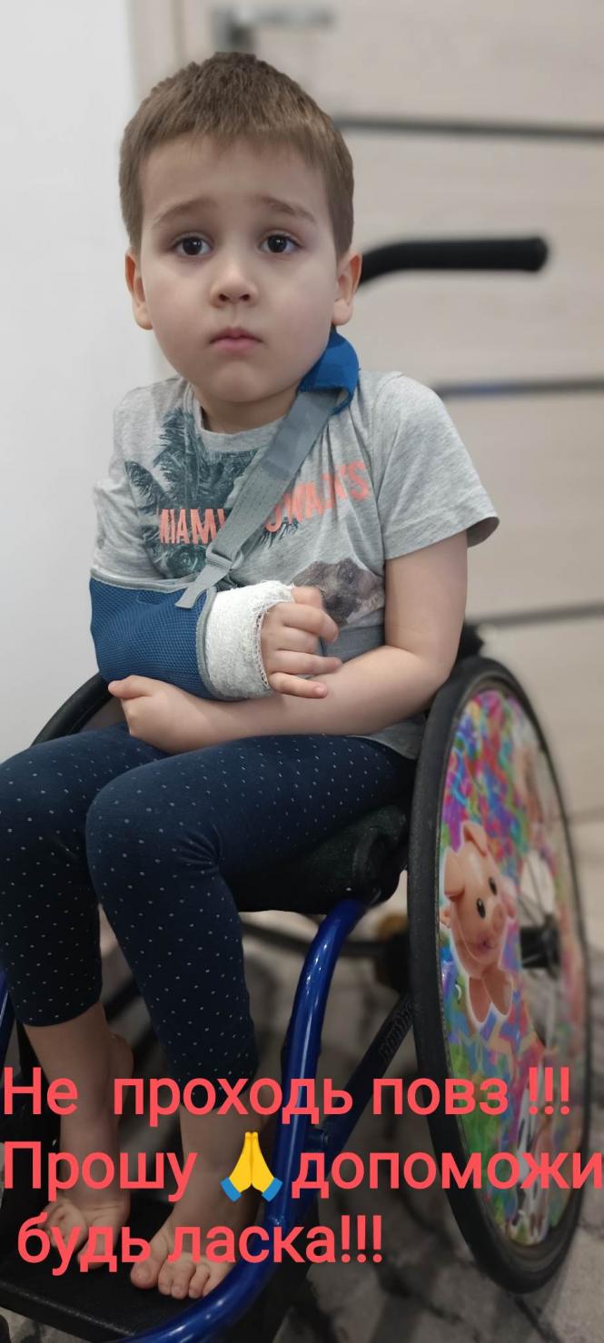 Новини Вінниці - фото з Необхідно майже 700 тисяч гривень. Маленькому Назарчику потрібна наша допомога