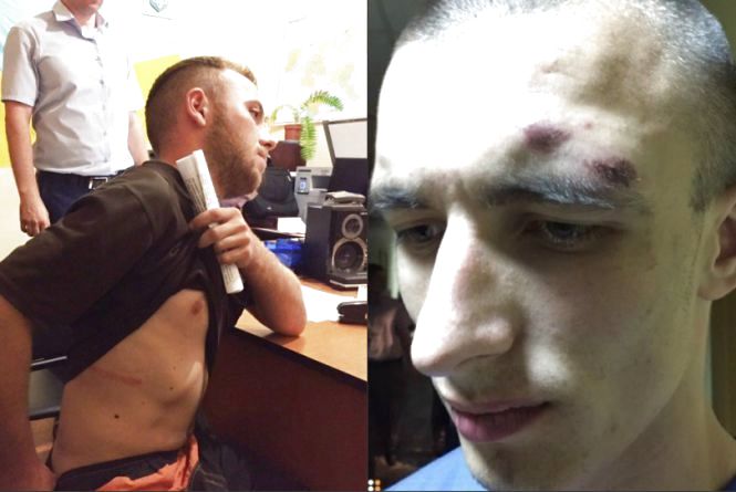 Новини Хмельницького - фото з Вибух у Шевченківському суді Києва: загинув “свободівець” Гуменюк з Хмельниччини (ОНОВЛЕНО) Адвокат надав фото побоїв Гуменюка і Бурлика