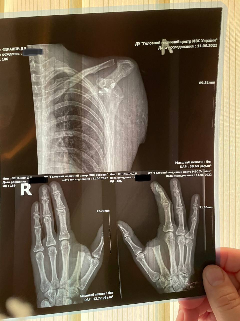 Новини Вінниці - фото з «Дві доби пив воду з калюж, повз до позицій». Козятинчанин Дмитро Фінашин потрапив до списку Forbes