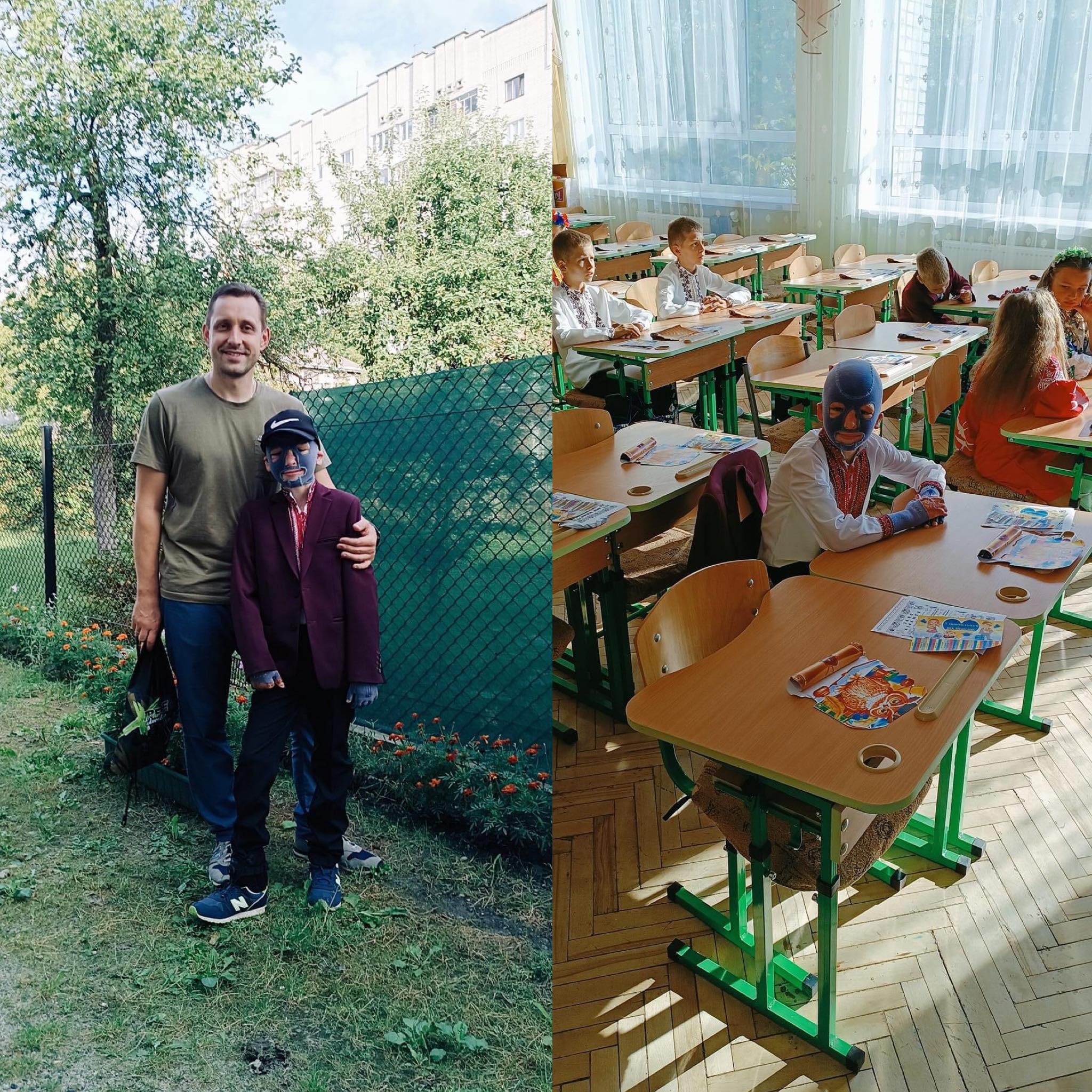 Новини Вінниці - фото з Ромчик, який дивом вижив після ракетного обстрілу Вінниці, повернувся з Німеччини в Україну