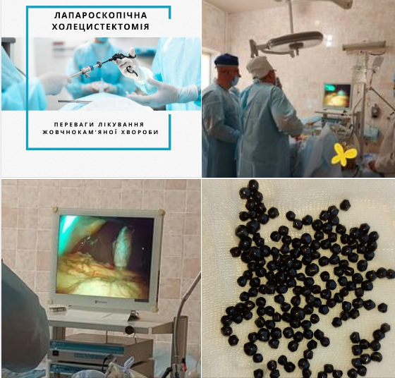 Новини Козятина - фото з «Вітаємо Жмеринку, шкода Козятин!» Реакції козятинчан на відкриття відділення малоінвазивної хірургії