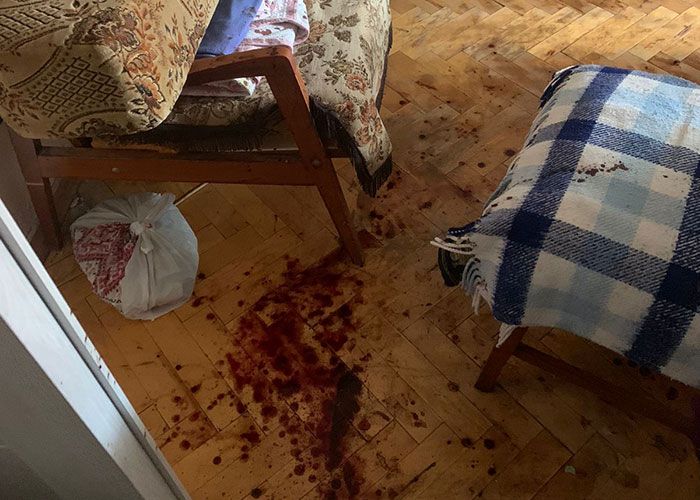 Новини Тернополя - фото з Гвинтівка, ножі і хімія в каністрах: у поліції повідомили подробиці інциденту на вулиці Гузара