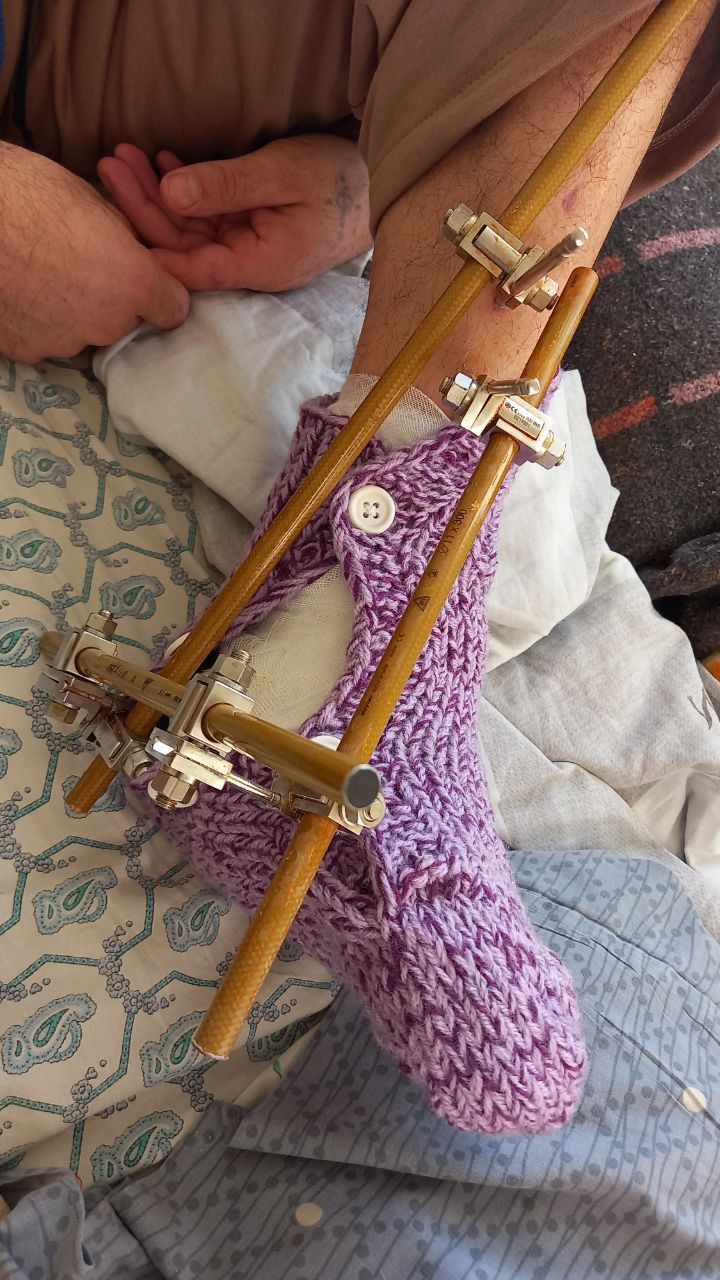 Новини Тернополя - фото з На липучках та зав’язках: «Швейна рота» у Тернополі створює адаптивний одяг для поранених бійців