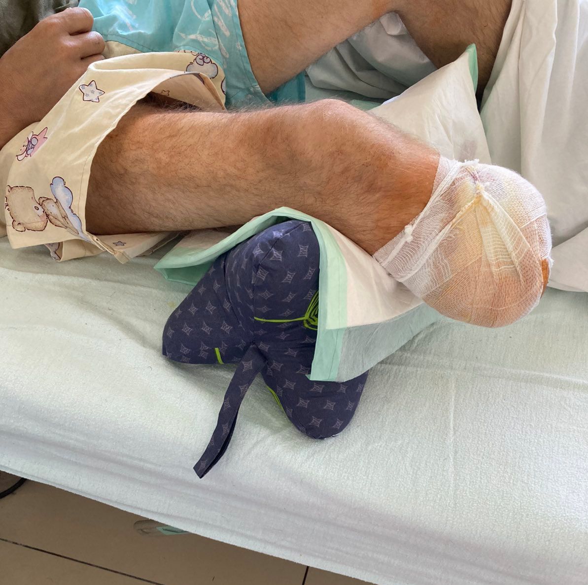 Новини Тернополя - фото з На липучках та зав’язках: «Швейна рота» у Тернополі створює адаптивний одяг для поранених бійців