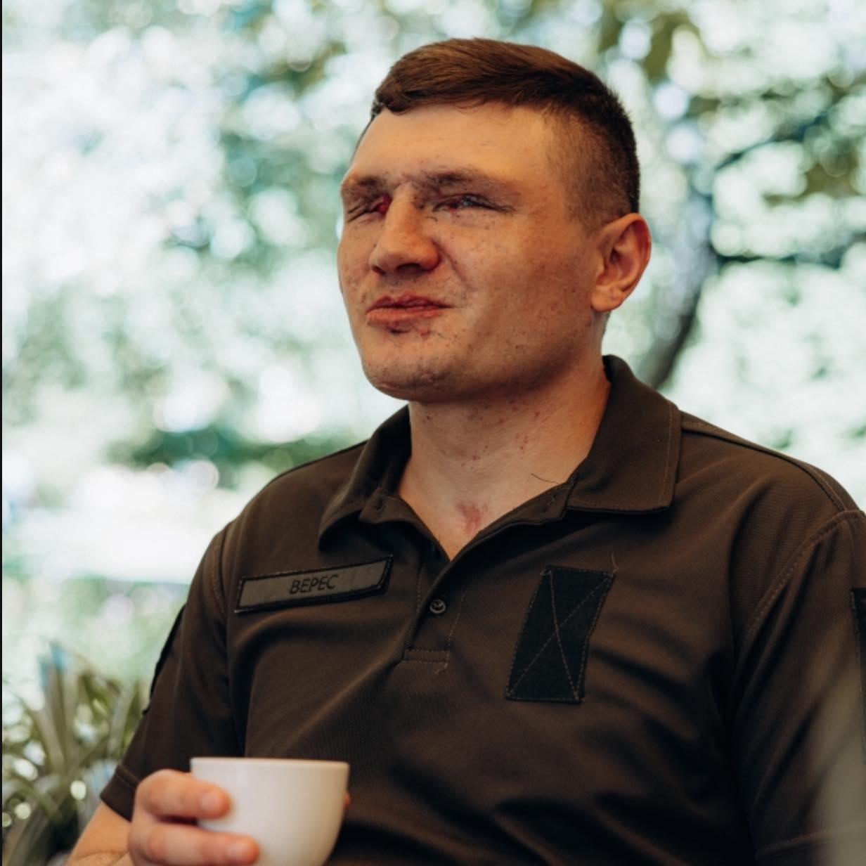 Новини Вінниці - фото з «Я зробив те, що мав би зробити кожен чоловік». Незламний: втратив зір на війні, але каже, що щасливий