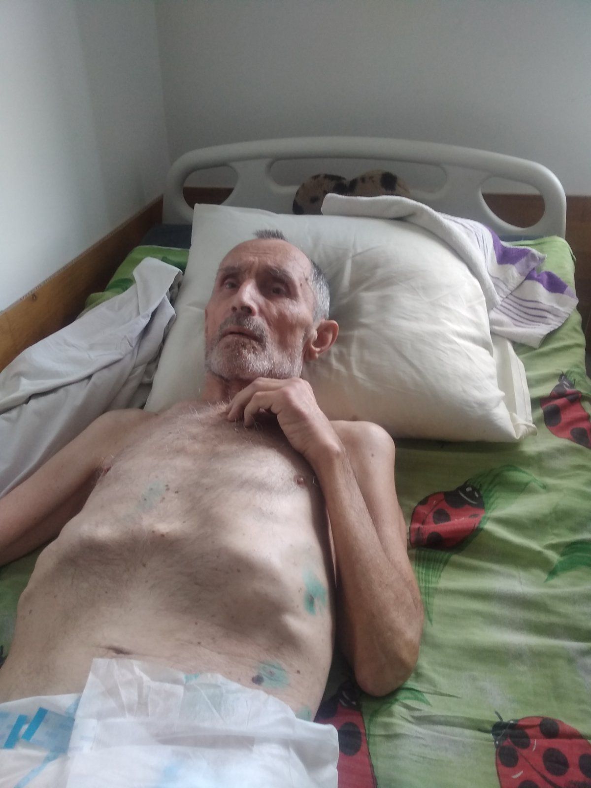 Новини Вінниці - фото з «У нього все одно пів мозку померло…» Родичі хворого скаржаться на лікарів паліативного відділення