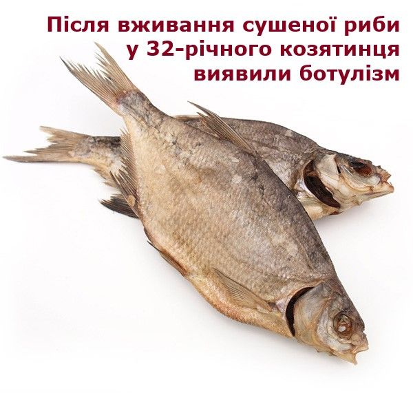Новини Козятина - фото з Поїв сушених карасів і потрапив до лікарні: у Козятині є випадок ботулізму