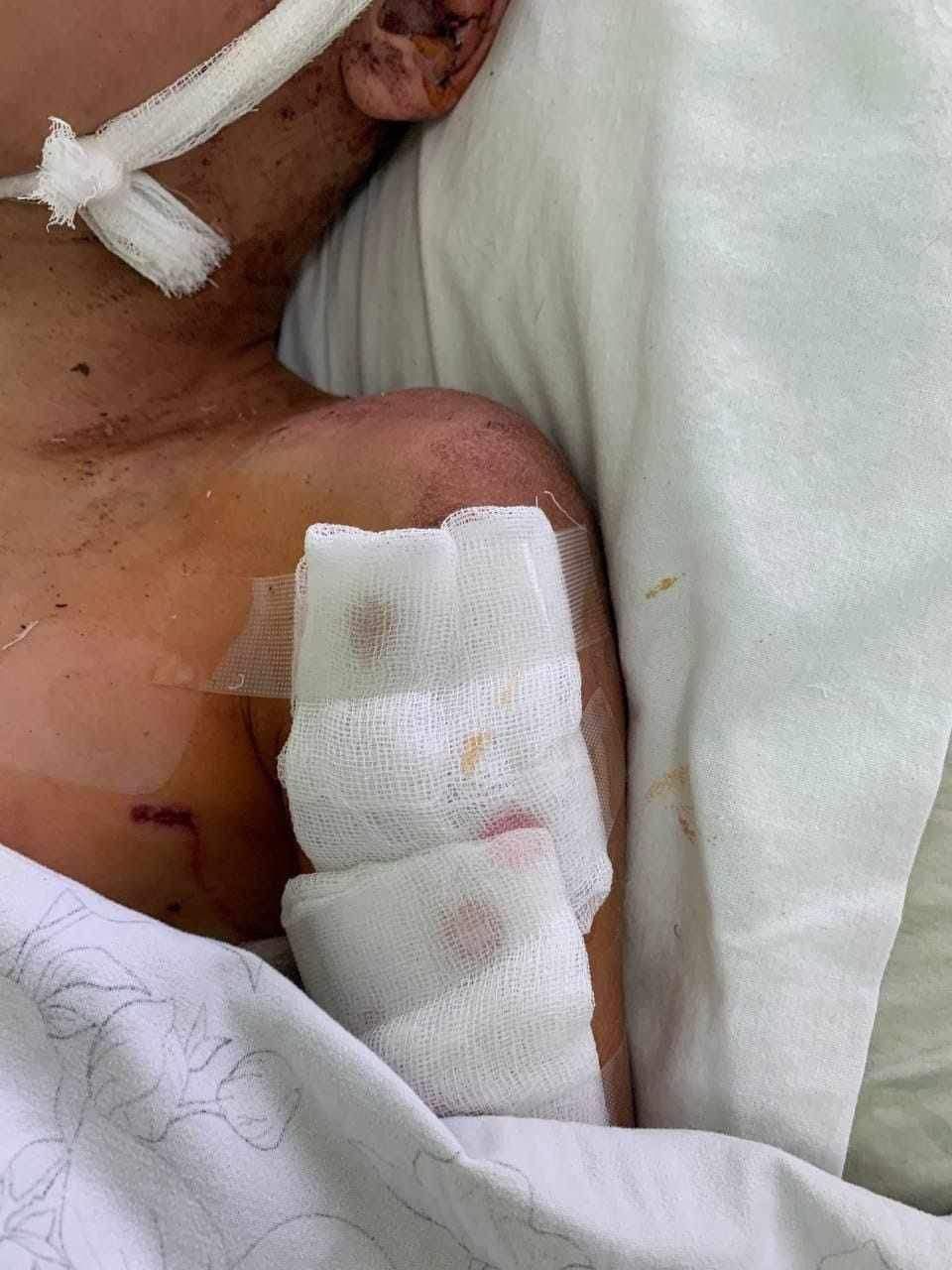 Новини Вінниці - фото з «Я не хочу помирати!» У Жмеринці 12-річного хлопчика покусали собаки