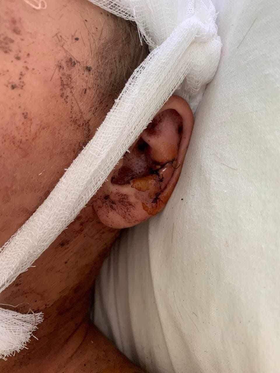 Новини Вінниці - фото з «Я не хочу помирати!» У Жмеринці 12-річного хлопчика покусали собаки