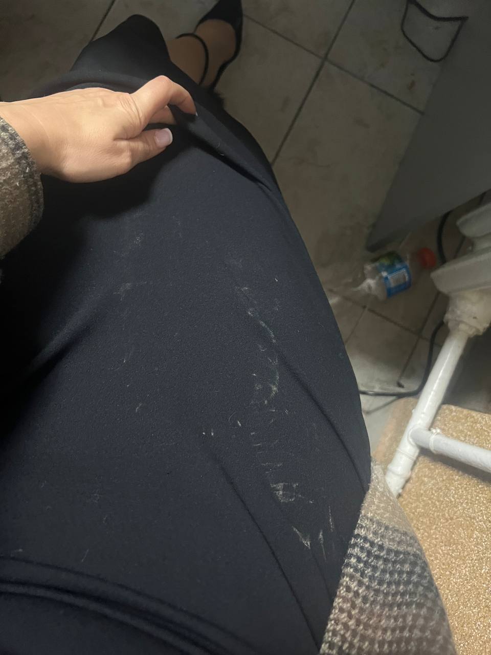 Новини Хмельницького - фото з “Він зламав мені ребро”: у Хмельницькому побили волонтерку