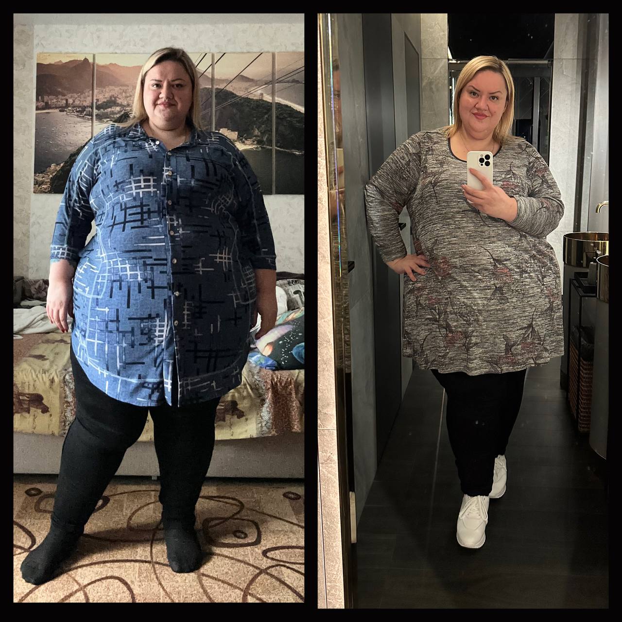 Новини Вінниці - фото з «Мені майже 40, а я вперше починаю жити на повну»: жінка, що важила 252 кіло й і почала худнути