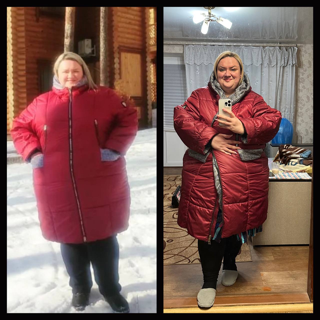 Новини Вінниці - фото з «Мені майже 40, а я вперше починаю жити на повну»: жінка, що важила 252 кіло й і почала худнути