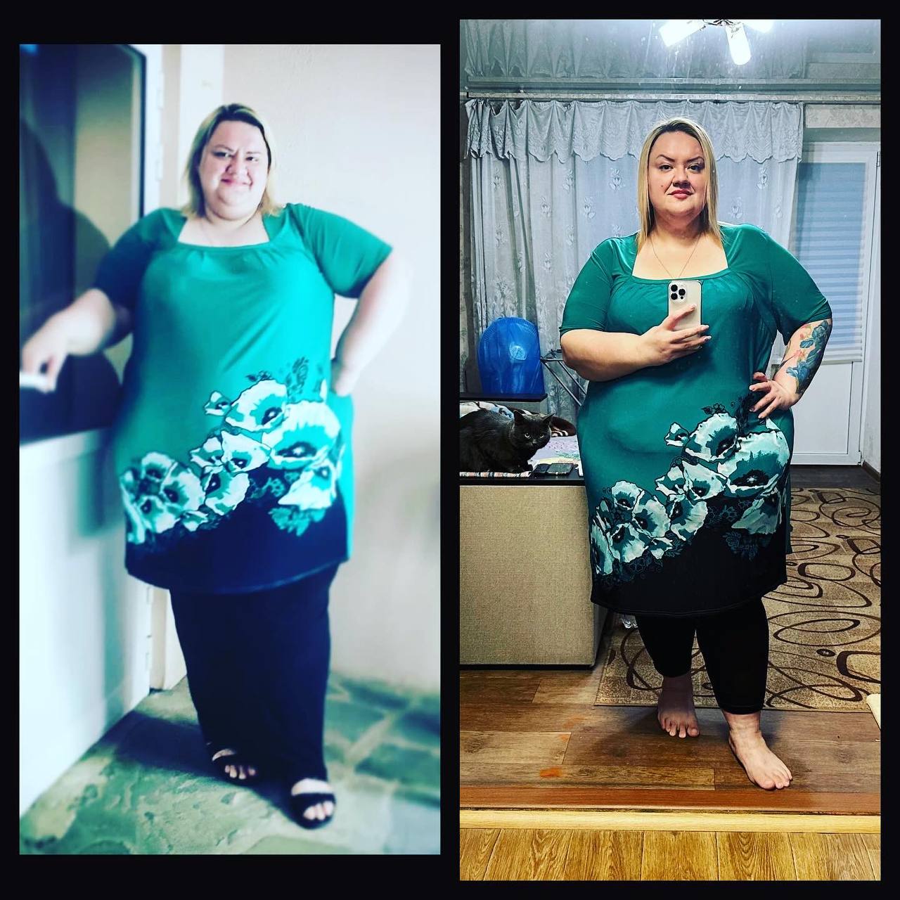 Новини Вінниці - фото з «Мені майже 40, а я вперше починаю жити на повну»: жінка, що важила 252 кіло й і почала худнути