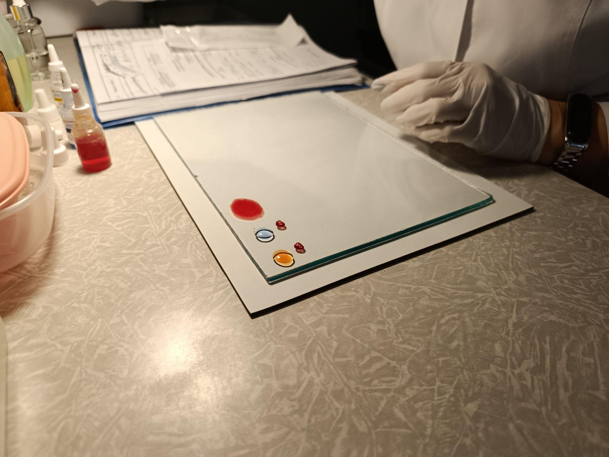 Новини Тернополя - фото з Терміново потрібна кров для військових! Журналісти «20 хвилин» перевірили, як  стати донором у Тернополі