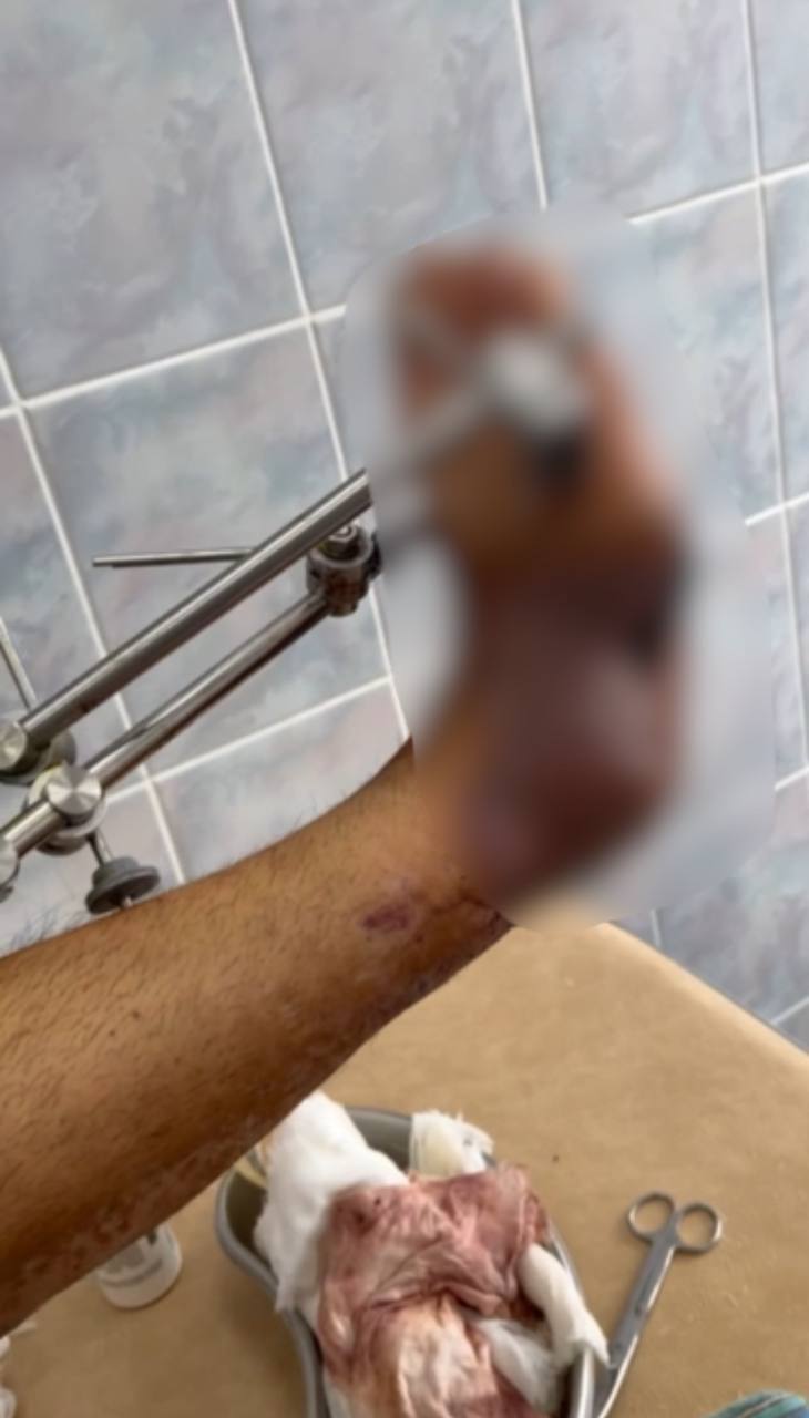 Новини Тернополя - фото з Він хоче ходити і повернутися на фронт: родина захисника з Теребовлі збирає 700 тисяч на лікування