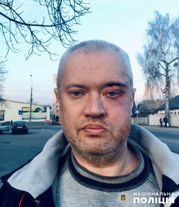 поліція розшукує безвісно зниклого 48-річного житомирянина