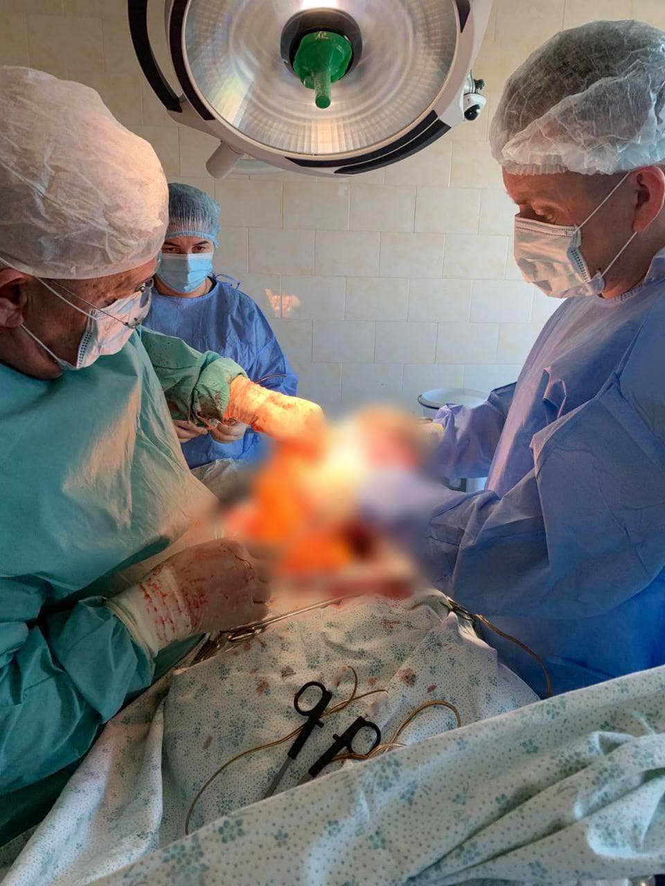 Новини Тернополя - фото з У Тернополі жінці видалили 9,5-кілограмову пухлину